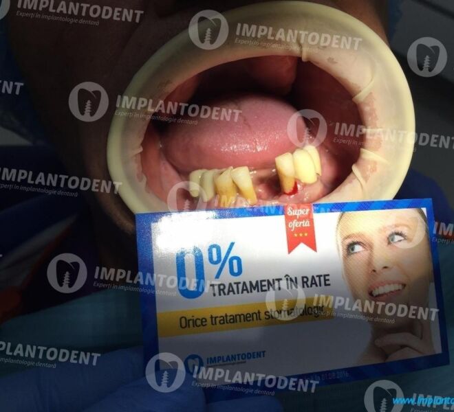 implant-german-06